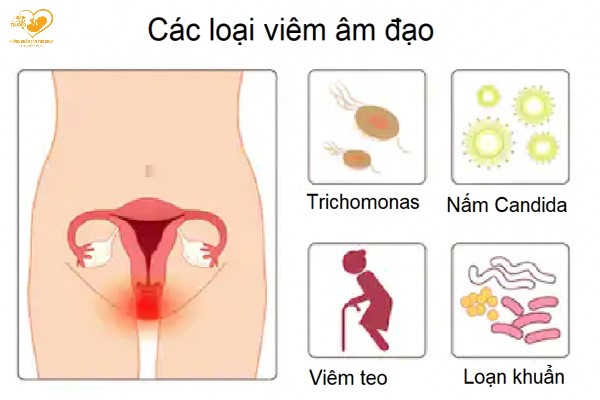bệnh phụ khoa