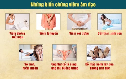 viêm âm đạo do nấm candida