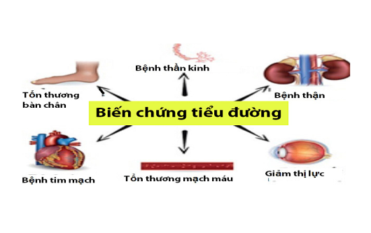 bệnh đái tháo đường