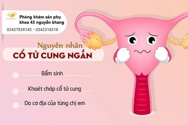 cổ tử cung ngắn