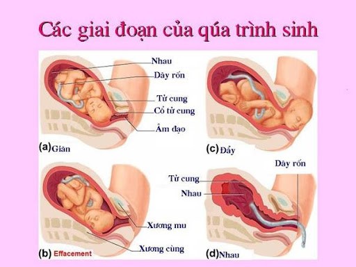 chuyển dạ