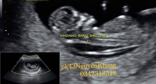 khám thai lần đầu