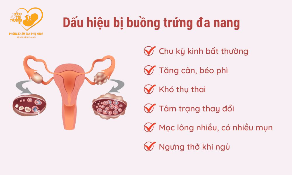 dấu hiệu của buồng chứng đa nang khiến các mẹ khó thụ thai 