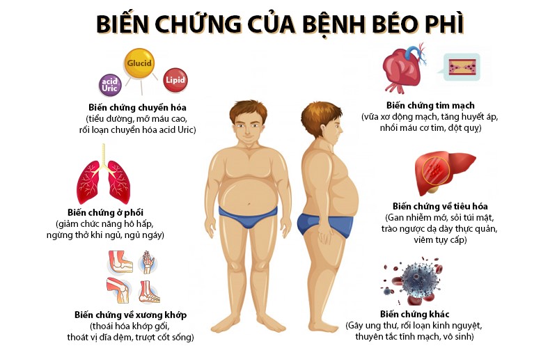 điều trị béo phì