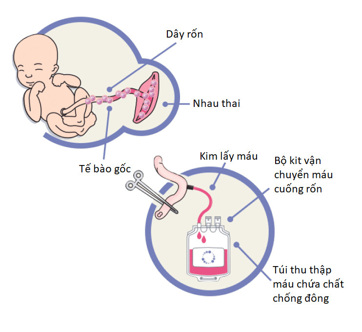 kỹ thuật lấy máu cuống rốn