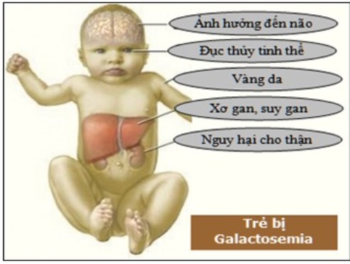 lấy máu gót chân