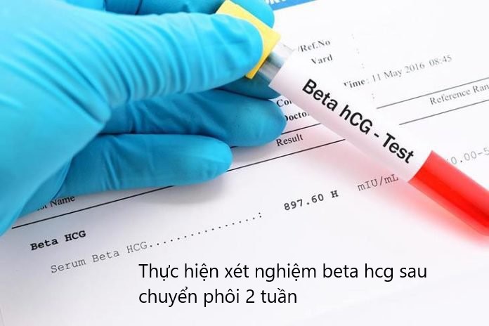 lưu ý sau chuyển phôi