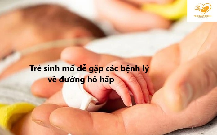 mổ lấy thai