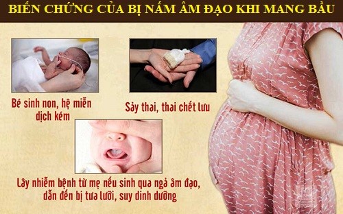 nấm âm đạo