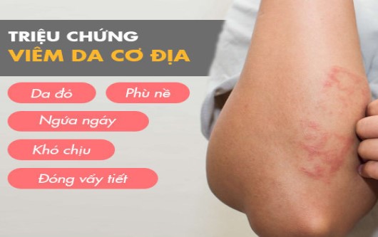 viêm da dị ứng khi mang thai