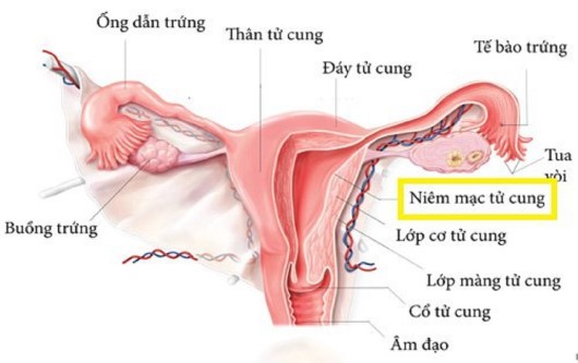 Nội mạc tử cung mỏng có ảnh hưởng đến hiệu quả khi làm ivf không, nội mạc tử tung mỏng có ảnh hưởng đến khả năng thụ thai, ivf, thụ tinh trong ống nghiệm, nội mạc tử cung mỏng
