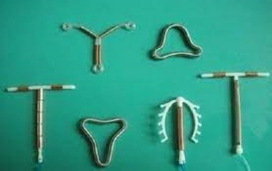 Dụng cụ tử cung biện pháp tránh thai an toàn và tiết kiệm