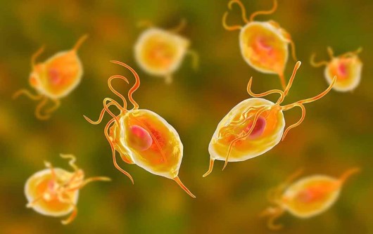 Viêm âm đạo do trichomoniasis