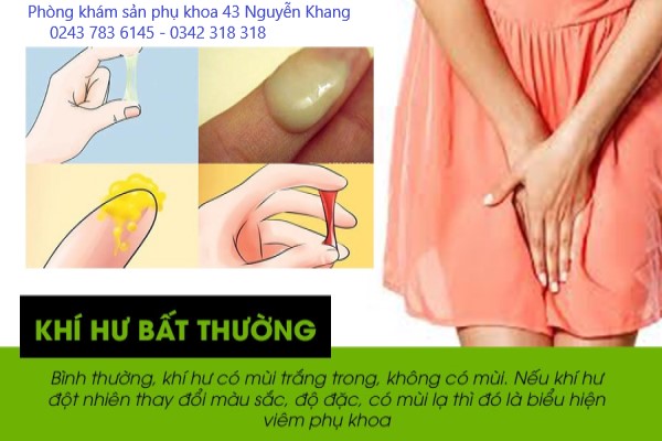 khí hư 