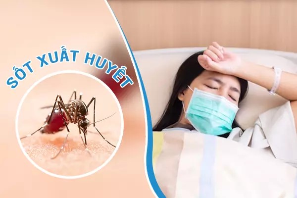 sốt xuất huyết khi mang thai