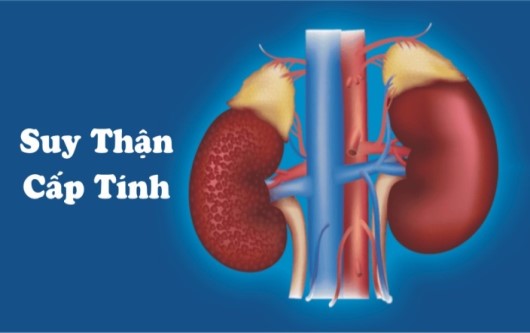 viêm thận bể thận cấp