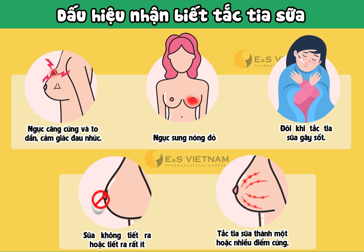 tắc tia sữa sau sinh