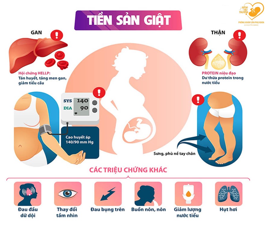 tiền sản giật nguy hiểm như thế nào