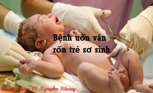 uốn ván