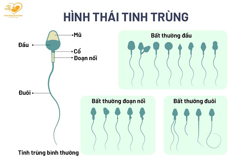 tinh trùng dị dạng