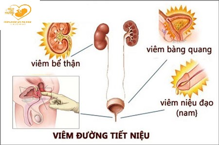 xét nghiệm nước tiểu