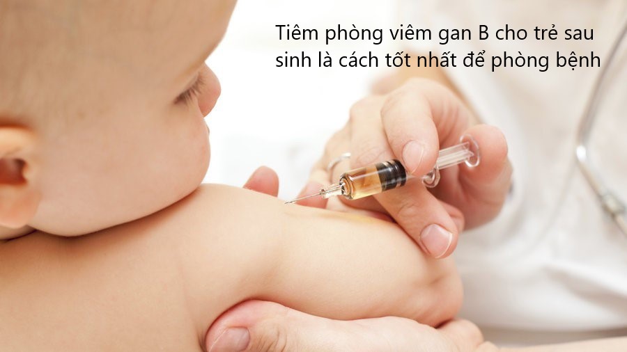 viêm gan b