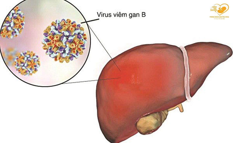 viêm gan B