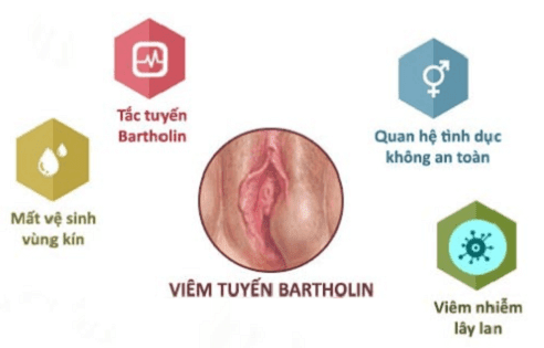 viêm tuyến bartholin có mang thai được không