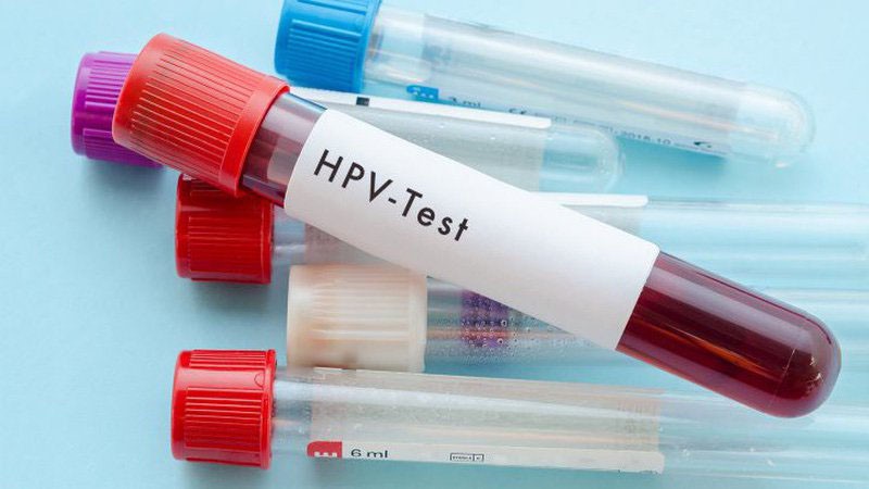 xét nghiệm hpv