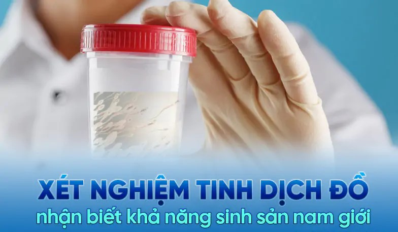 xét nghiệm tinh dịch đồ