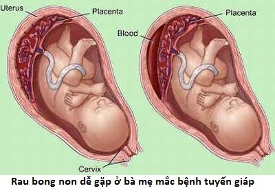 xét nghiệm tuyến giáp